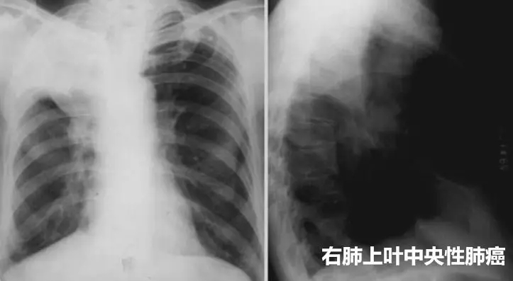 文章附圖