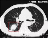 文章附圖